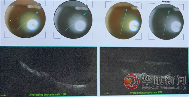 2032570519725525_176.png 2032570519725525_176.png