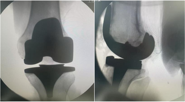 20254136881295579_176.png 20254136881295579_176.png